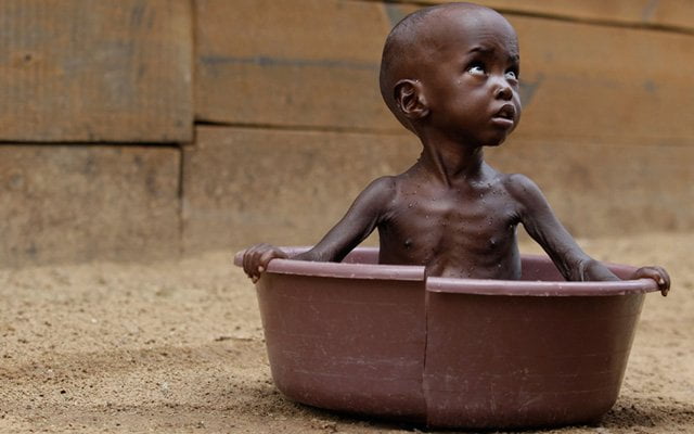 Türk Kızılayı Somali’nin açlık sorununa çare arıyor