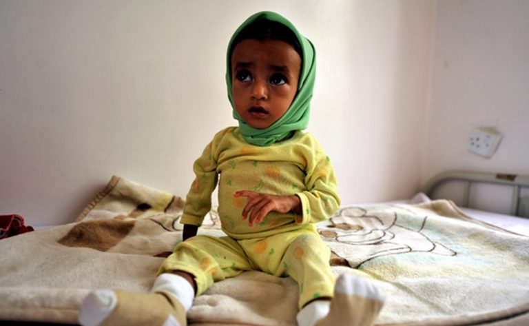 Yemen 2020: Olabilecek En Korkunç Felaket
