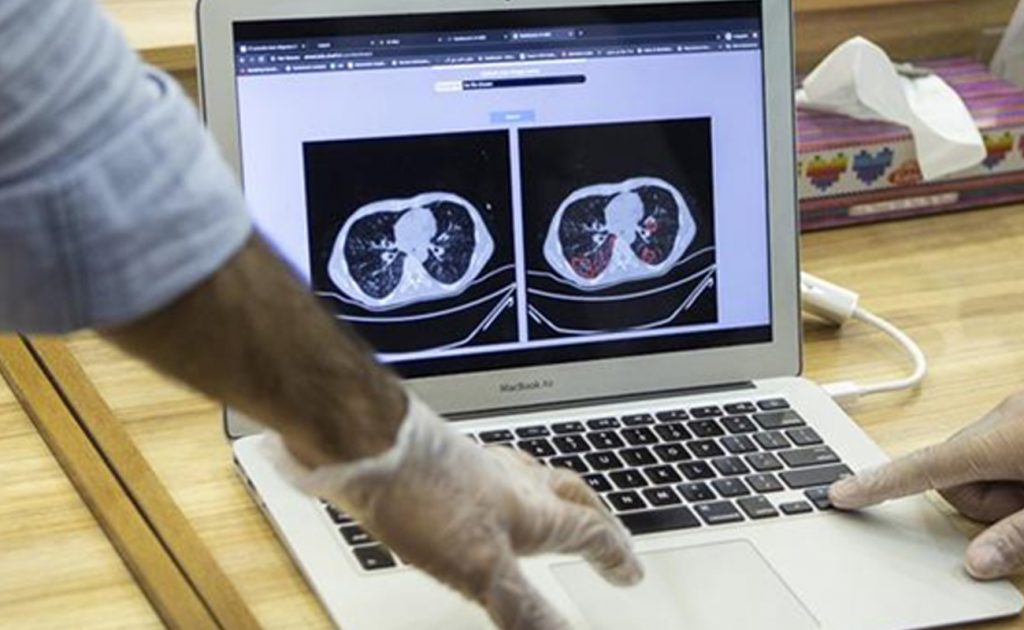 İran’dan Yapay Zekalı Korona Tanı Teknolojisi