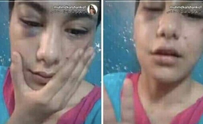 Mısır: Tecavüz Kurbanı Tutuklu Tecavüzcü Serbest