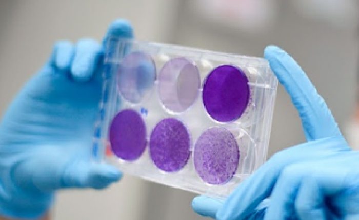 Fransızlar Alkol Testi Tarzı Korona Testi Geliştirdi