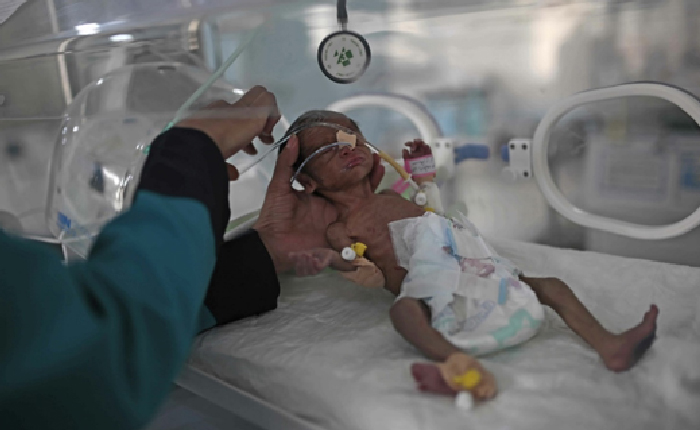 BM Yemen Kıtlığına Dikkat Çekti