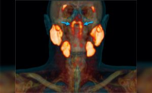 Bilim Adamları: Kafamızda Gizli Organ Var