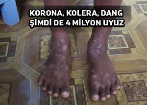 Yemen’in yollara dökülen milyonları arasında uyuz salgını başladı