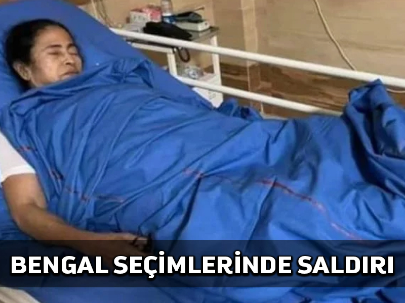 Bengal Başbakanı BJP saldırısında ağır yaralı