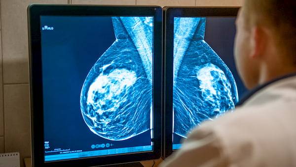 Mamografi taramasını atlamak hayati risk oluşturabilir