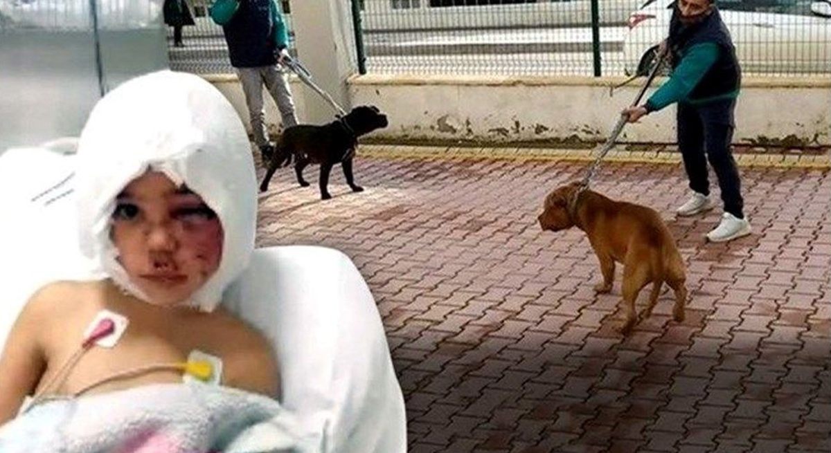 Pitbull Saldırısı Sonrası Doku Nakli Yapılan Asiye Bugün Uyandırılacak