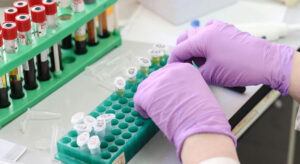 SMA Taşıyan Çiftlere Devletten Tüp Bebek Desteği