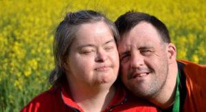 Yapılan Bir Çalışma Down Sendromlu Yetişkinler Arasında COVID-19 Mortalitesinin (Ölüm) Arttığını Bulmuştur