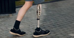 Kalçamda protez var çoraplarıma mesh edebilir miyim?