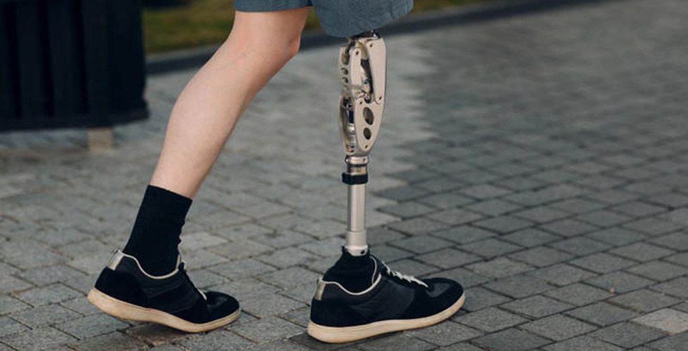 Kalçamda protez var çoraplarıma mesh edebilir miyim?