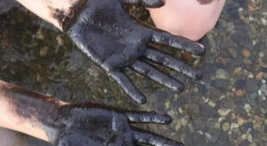 Dünyaca Ünlü Plajda Gözüktü..