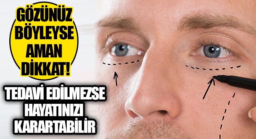 Gözünüz Böyleyse Dikkat!