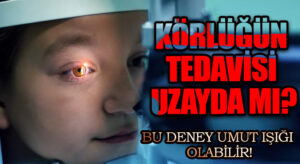 Körlüğün Tedavisi Uzayda Mı?