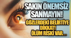 SAKIN ÖNEMSİZ SANMAYIN! GÖZLERDEKİ BELİRTİYE DİKKAT! ÖLÜM RİSKİ VAR…