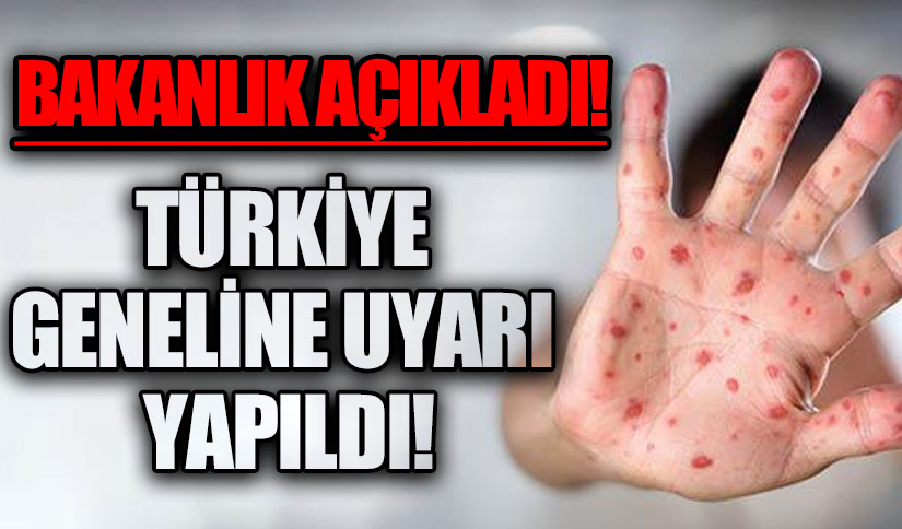Sağlık Bakanlığından Türkiye Geneline Uyarı!
