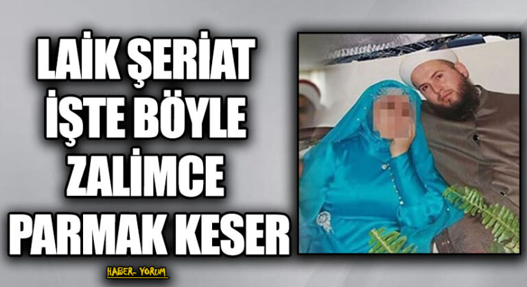 LAİK ŞERİAT İŞTE BÖYLE ZALİMCE PARMAK KESER