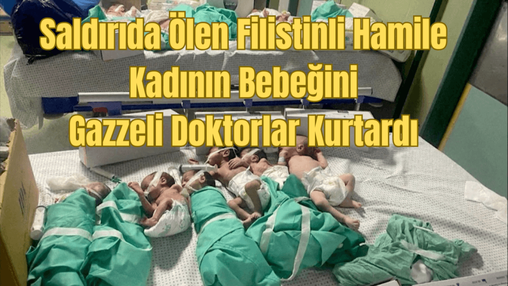 Ölen Filistinli Hamile Kadının Bebeğini Gazzeli Doktorlar Kurtardı