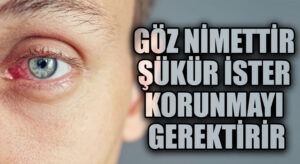 GÖZ NİMETTİR ŞÜKÜR İSTER KORUNMAYI GEREKTİRİR