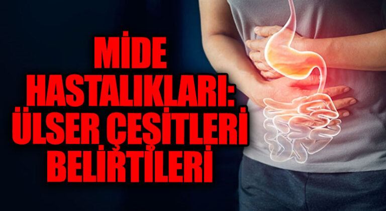 Mide Hastalıkları: Ülser Çeşitleri Belirtileri