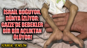 İsrail Boğuyor, Dünya İzliyor: Gazze’de Bebekler Bir Bir Açlıktan Ölüyor!