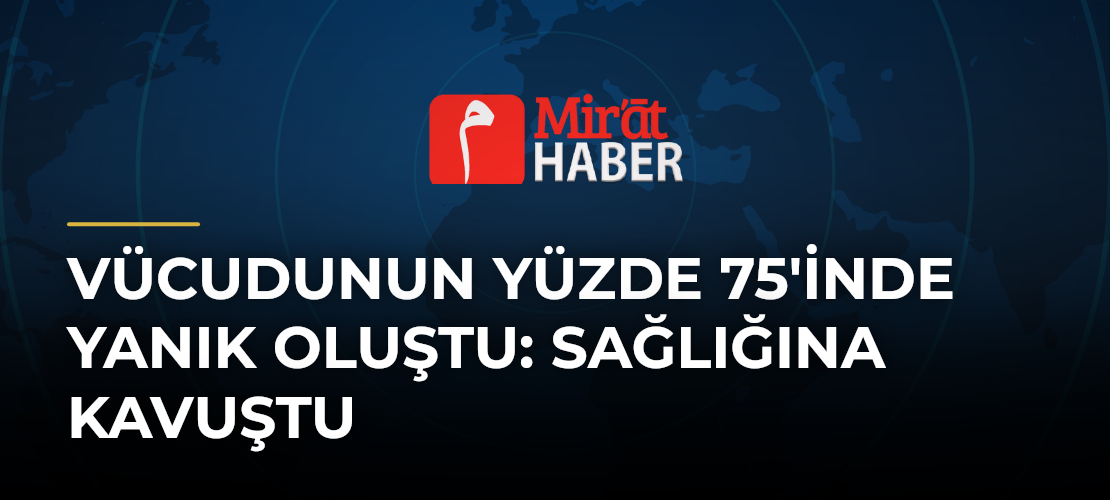 Vücudunun Yüzde 75'inde Yanık Oluştu: Sağlığına Kavuştu