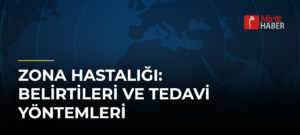 Zona Hastalığı: Belirtileri ve Tedavi Yöntemleri