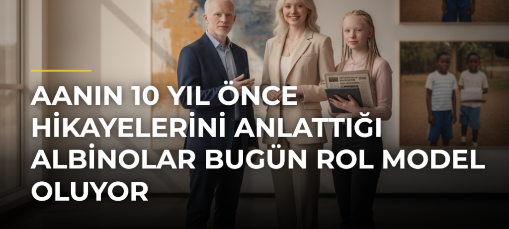 AAnın 10 yıl önce hikayelerini anlattığı albinolar bugün rol model oluyor
