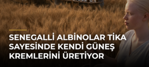 Senegalli albinolar TİKA sayesinde kendi güneş kremlerini üretiyor