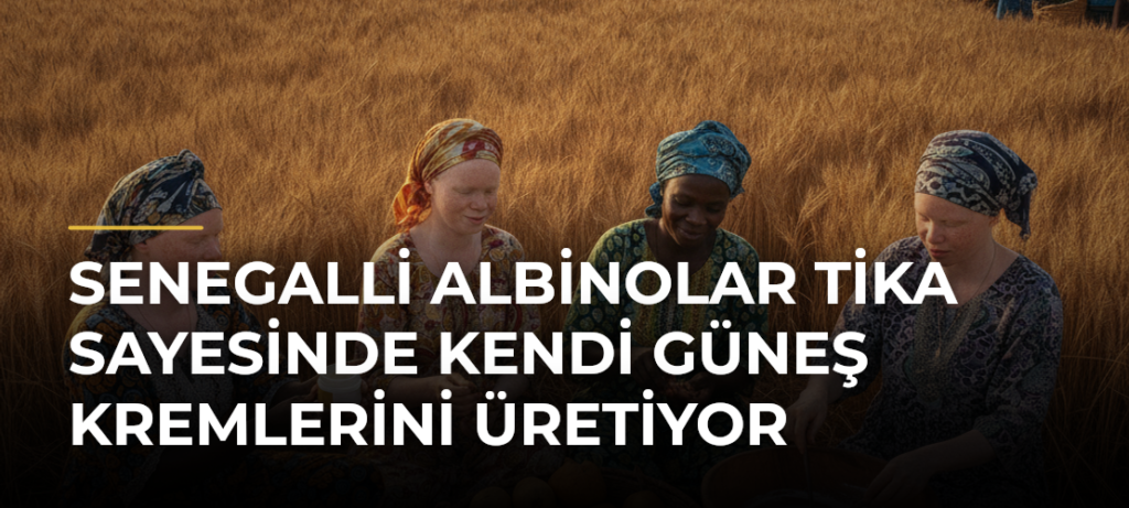 Senegalli albinolar TİKA sayesinde kendi güneş kremlerini üretiyor