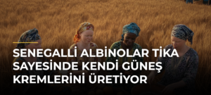 Senegalli albinolar TİKA sayesinde kendi güneş kremlerini üretiyor