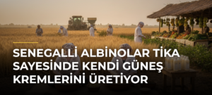 Senegalli albinolar TİKA sayesinde kendi güneş kremlerini üretiyor