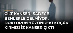 Cilt Kanseri Sadece Benlerle Gelmiyor: Doktorun Yüzündeki Küçük Kırmızı İz Kanser Çıktı
