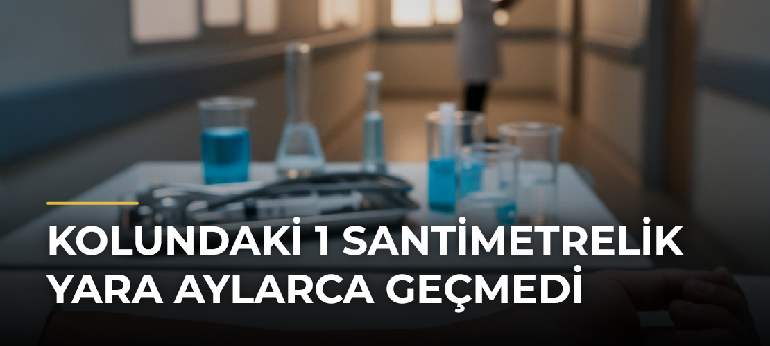 Kolundaki 1 Santimetrelik Yara Aylarca Geçmedi - Mirat Haber
