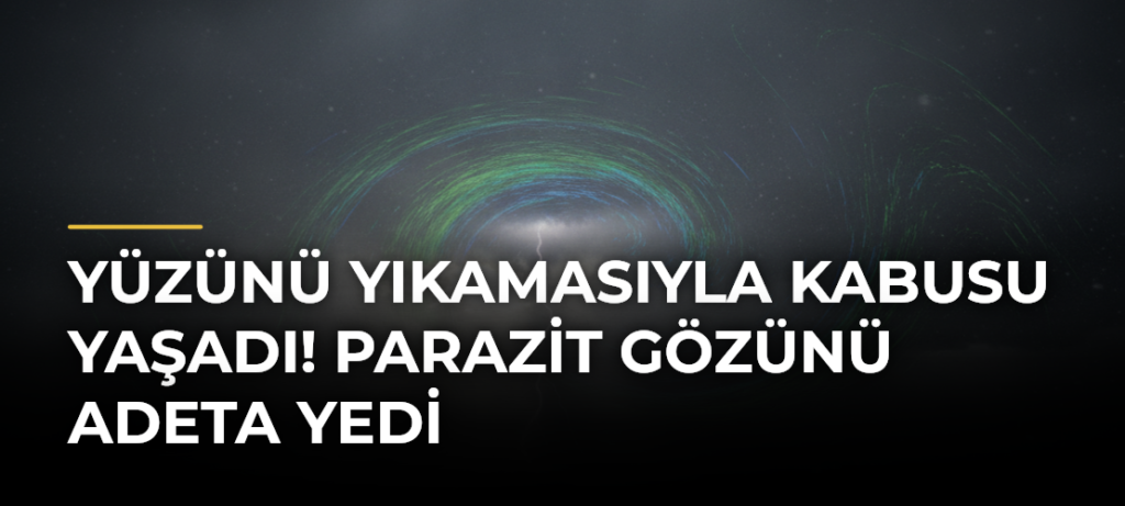 Yüzünü yıkamasıyla kabusu yaşadı! Parazit gözünü adeta yedi