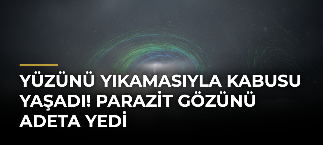 Yüzünü yıkamasıyla kabusu yaşadı! Parazit gözünü adeta yedi