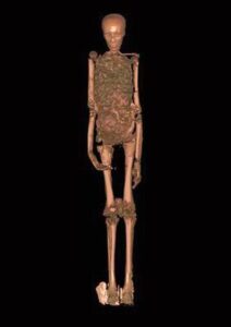 Resim: Tarihi Eserler Yüksek Konseyi (Supreme Council of Antiquities) tarafından sağlanan bu fotoğraf, Tutankhamun'un mumyasına yapılan bir BT (Bilgisayarlı Tomografi) taramasını göstermektedir. (Fotoğraf: Associated Press).