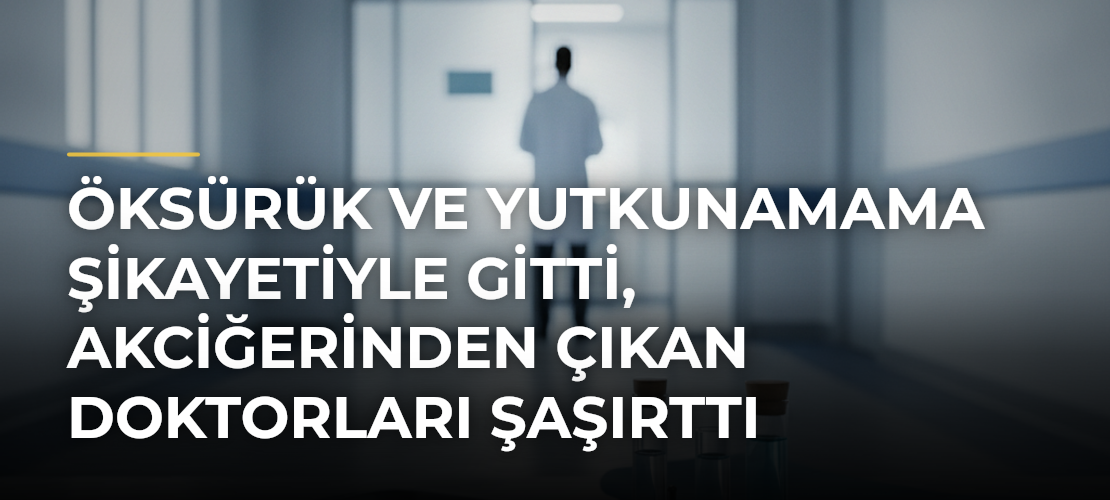 Öksürük ve Yutkunamama Şikayetiyle Gitti, Akciğerinden Çıkan Doktorları Şaşırttı - Mirat Haber